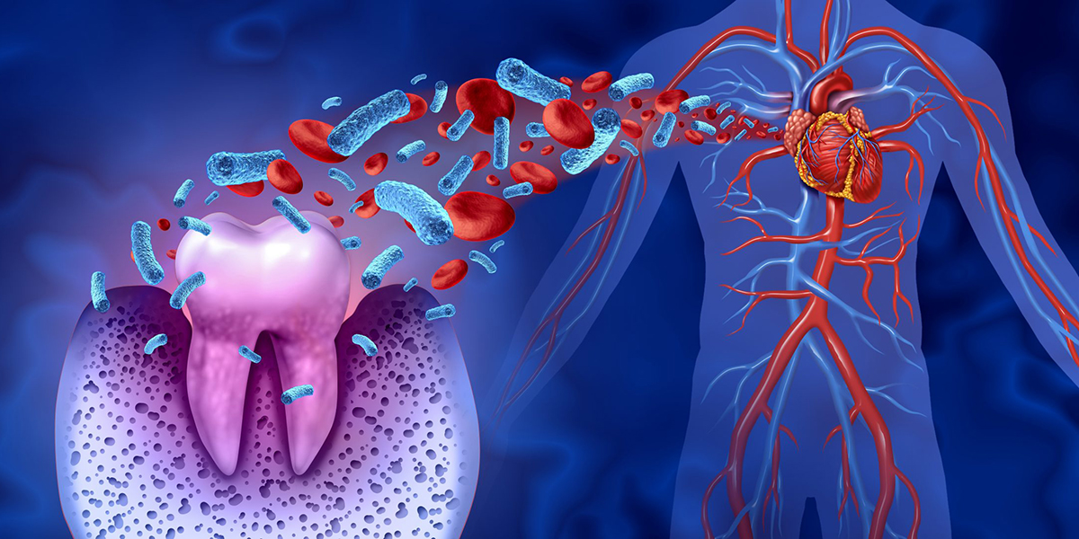 سکته قلبی به خاطر دندان پوسیده! چطور سلامت دهان و دندان بر کل بدن تأثیر می گذارد
